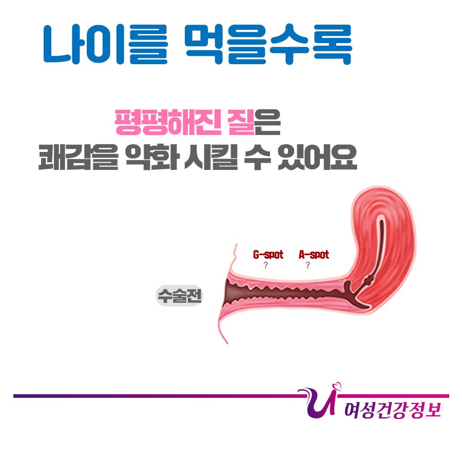 굴곡 있는 질이 좋다?! : 네이버 포스트