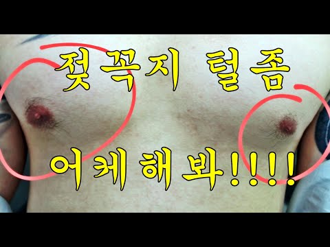 #유두제모 #젖꼭지털 #가슴제모 #젖꼭지제모  남자 유두제모